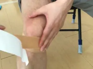 テーピング大腿部キネシオ膝蓋腱